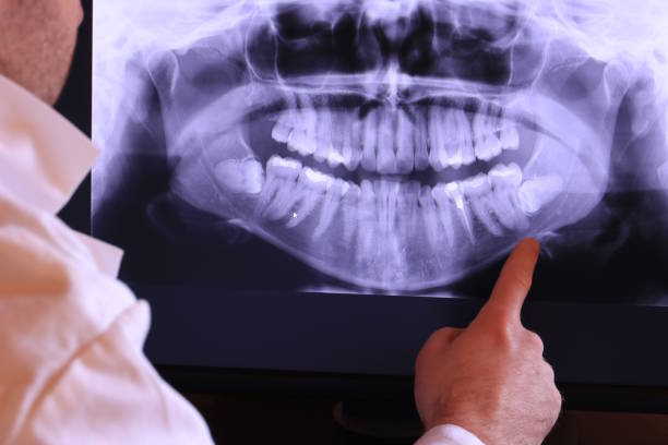 Best Emergency Dental Care for Trauma or Injury in Mount Arlington, NJ